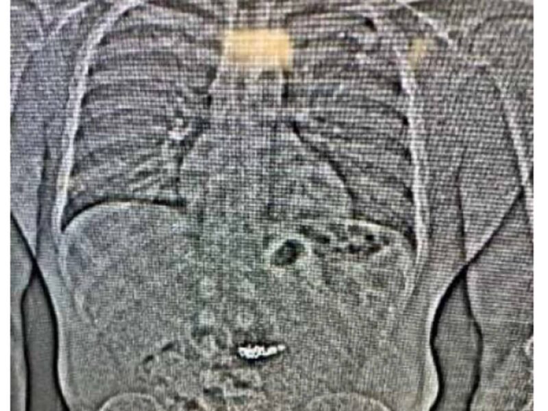 Man Arrested After Swallowing Stolen Tiffany & Co. Jewellery Worth Over $700,000 tiffany 1